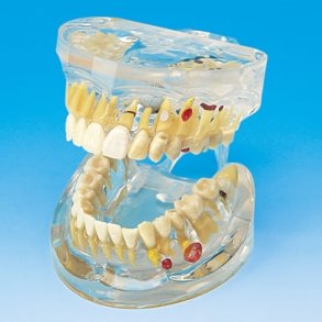 Transparent Sygdomsmodel